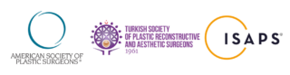 altb2